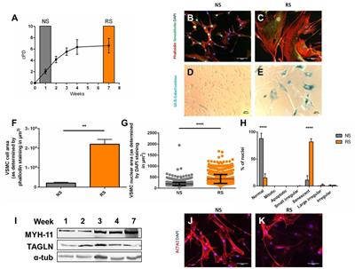 Inflammatory Drivers of Cardiovascular Disease: Molecular Characterization of Senescent Coronary Vascular Smooth Muscle Cells